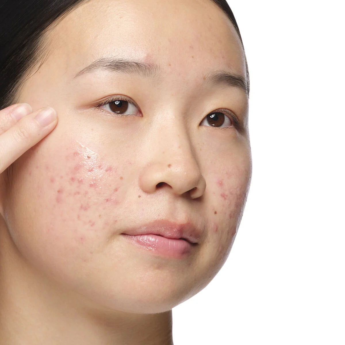 The Ordinary 2% + NAG 2% Solução