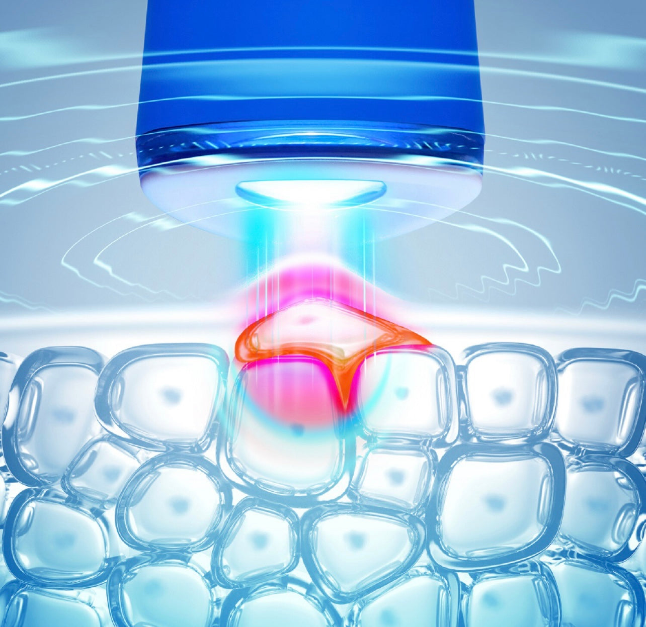 FOREO ESPADA Luz azul Terapia Dispositivo de Tratamento de Acne